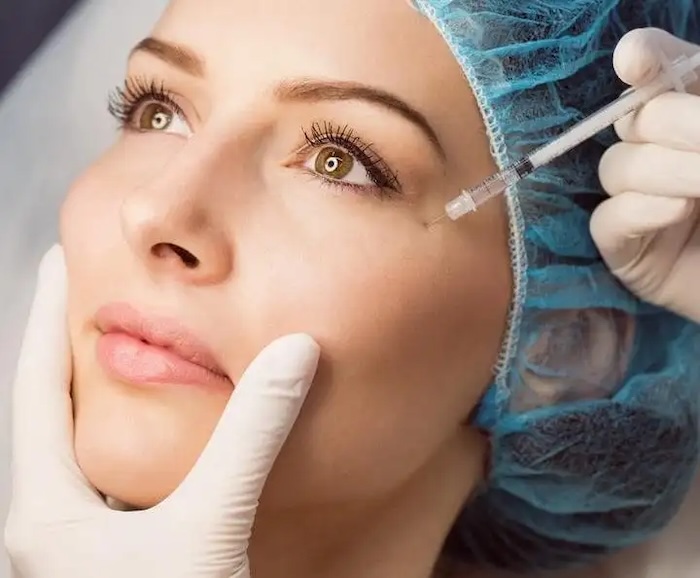 Cấy chỉ xoá thâm bọng mắt Cấy chỉ xoá thâm bọng mắt