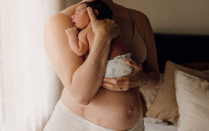 Da có dấu hiệu bị nám Da có dấu hiệu bị nám