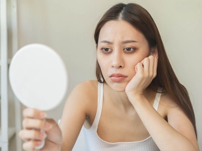 Kem trị thâm mắt cho tuổi dậy thì Kem trị thâm mắt cho tuổi dậy thì