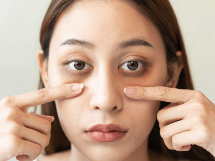 Kem trị thâm mắt escada Kem trị thâm mắt escada