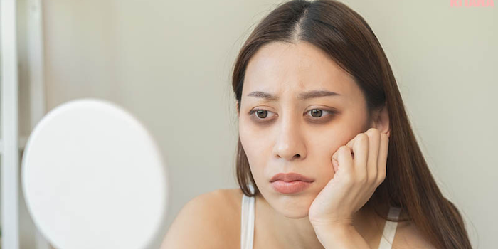 Kem trị thâm mắt hexapeptide Kem trị thâm mắt hexapeptide