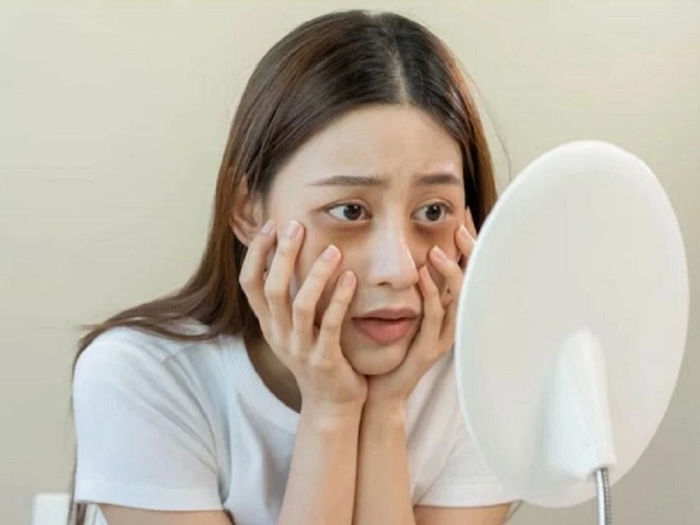 Kem trị thâm mắt hiệu quả Kem trị thâm mắt hiệu quả