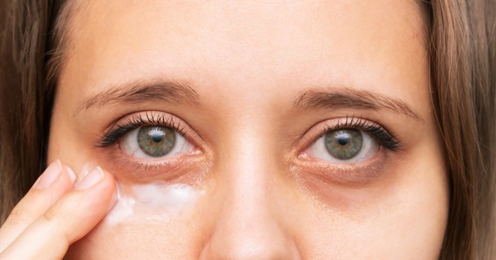 Kem trị thâm mắt kumargic Kem trị thâm mắt kumargic