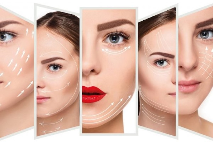 Nâng cơ giảm mỡ mặt