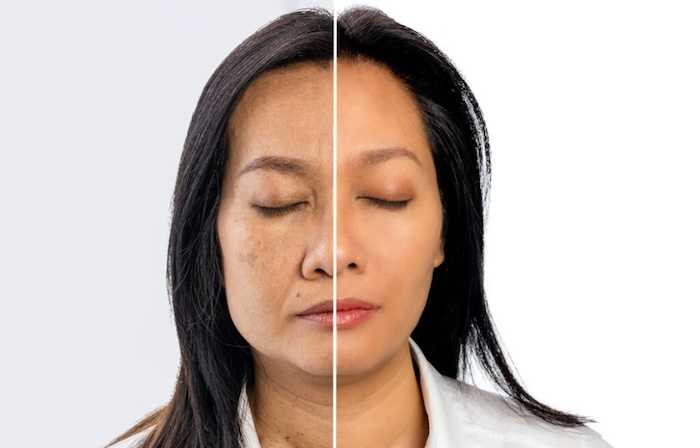 Nguyên nhân hình thành nám