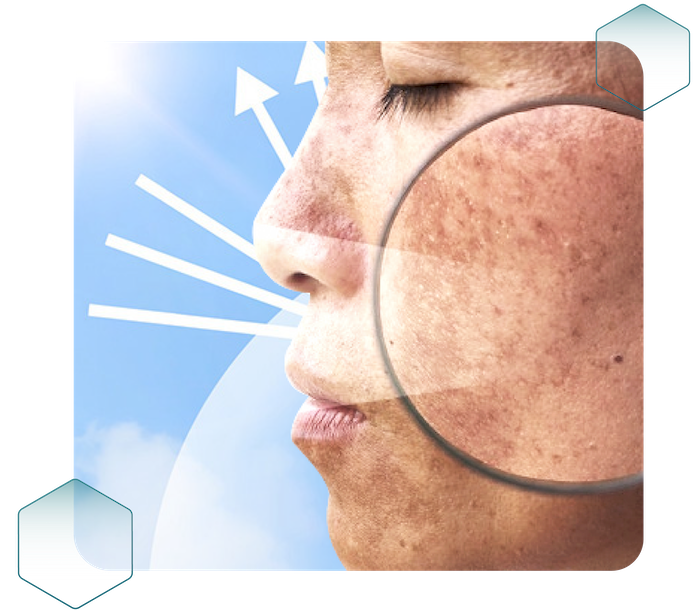 Phân loại các loại nám Phân loại các loại nám