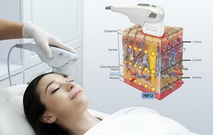 Phương pháp mri hifu ở đâu có