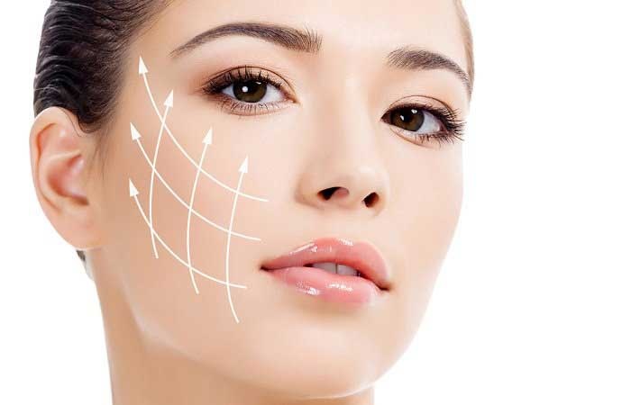 Tác dụng phụ của cấy chỉ nâng cơ mặt