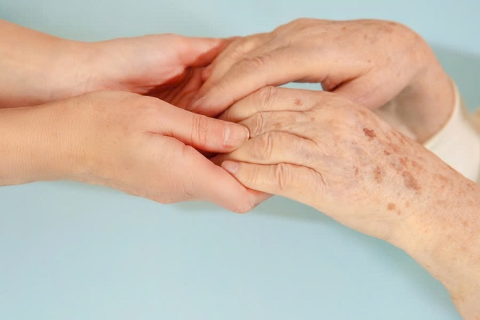Tay xuất hiện vết nám Tay xuất hiện vết nám