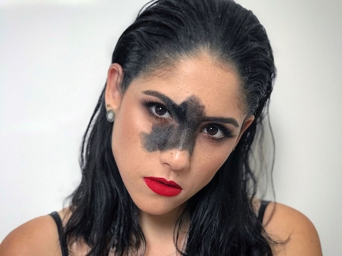 Trị chàm bẩm sinh