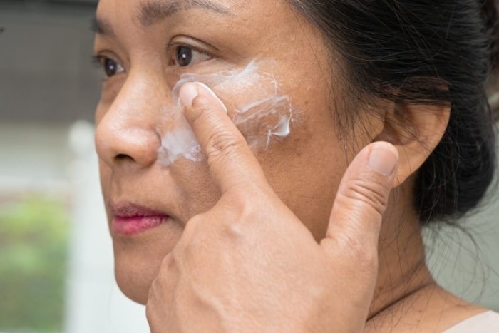 Trị nám bẩm sinh