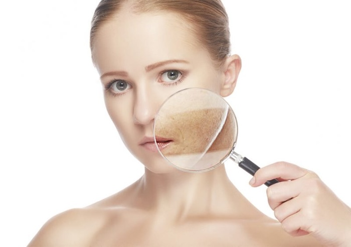 Trị nám bằng cách nào