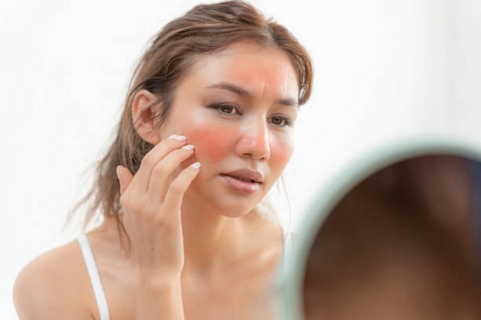 Trị nám bằng dầu oliu