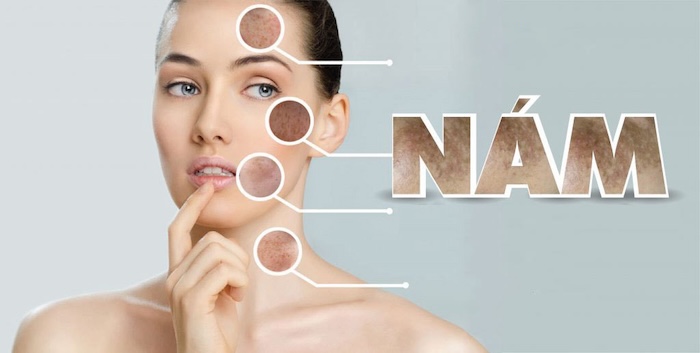Trị nám nội tiết