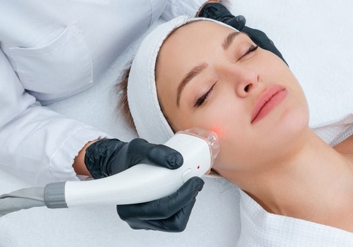 Trị nám picosure