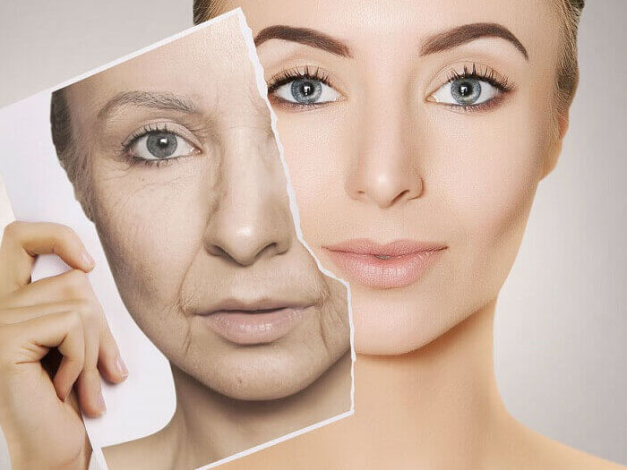 Xóa nhăn và nâng cơ mặt Xóa nhăn và nâng cơ mặt