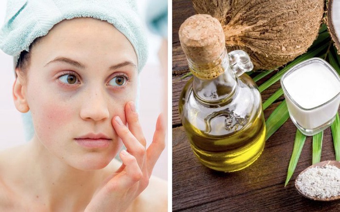 Xóa quầng thâm mắt bằng dầu dừa