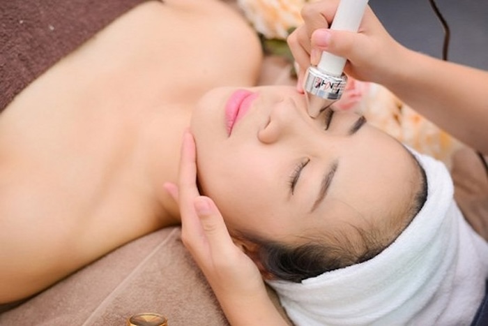 Xóa thâm quầng mắt bằng laser