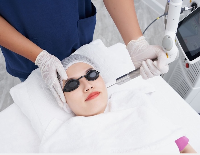 Bắn laser trị nám có tốt không