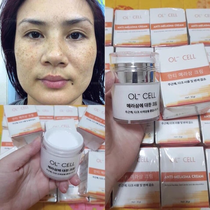 Cách sử dụng kem trị nám ol cell