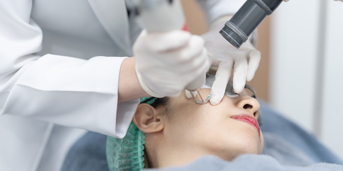 Máy laser trị nám giá bao nhiêu