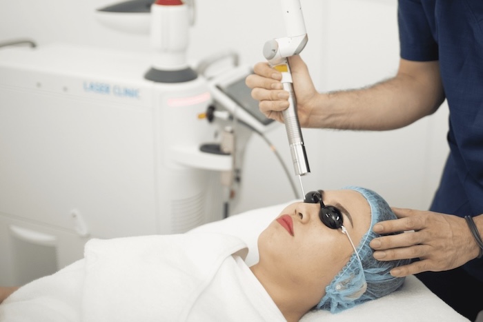 Điều trị nám bằng laser có hiệu quả không