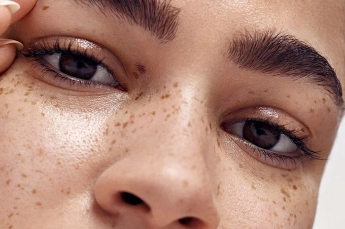 Điều trị nám chân đinh