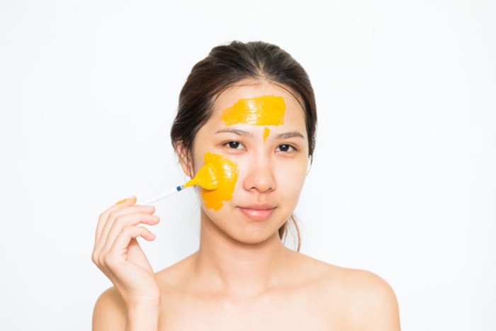 Kem nghệ có trị nám không Kem nghệ có trị nám không