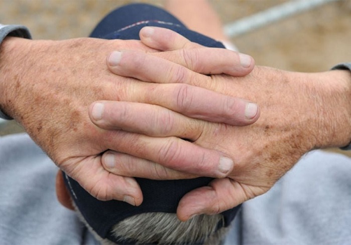 Nguyên nhân bị nám da tay Nguyên nhân bị nám da tay