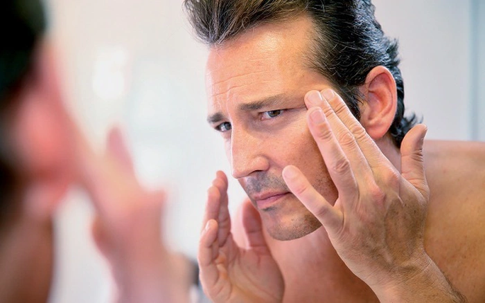 Nguyên nhân gây nám da mặt ở nam giới Nguyên nhân gây nám da mặt ở nam giới