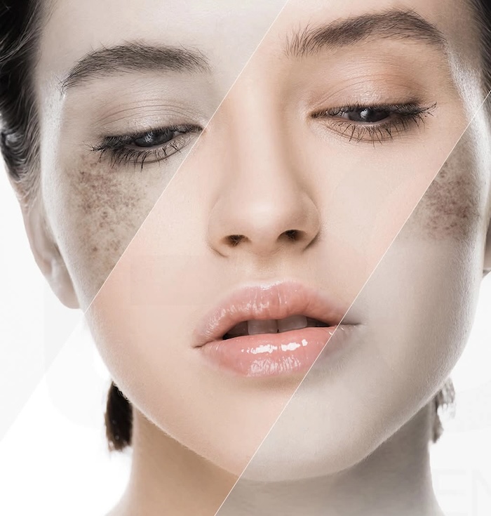 Pond cao cấp trị nám Pond cao cấp trị nám