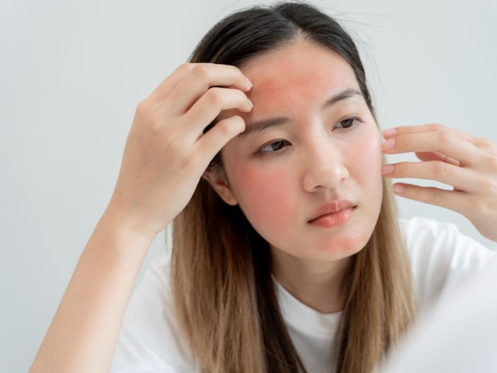 Sản phẩm dưỡng da trị nám Sản phẩm dưỡng da trị nám