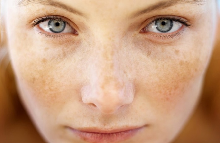 Serum trị nám trắng da của nhật