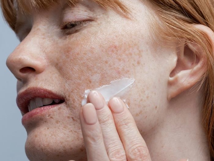 Kem trị nám mảng tốt nhất