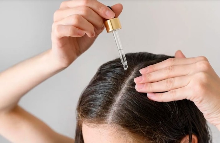 Cách chữa bệnh hói đầu Cách chữa bệnh hói đầu