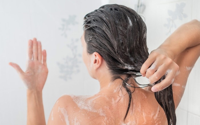 Cách chữa bệnh hói đầu di truyền