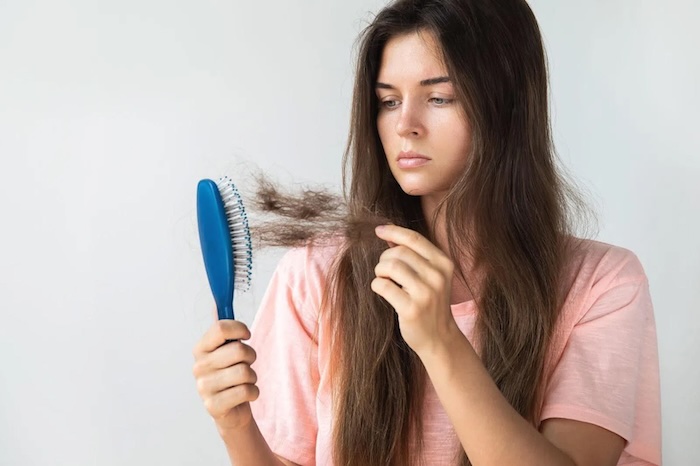 Cách chữa rụng tóc hói đầu hiệu quả