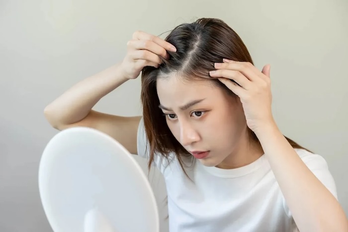 Cách để không bị hói
