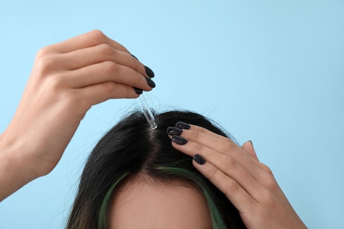 Cách điều trị rụng tóc hói đầu