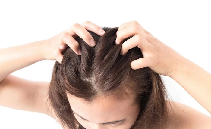 Cách mọc tóc khi bị hói