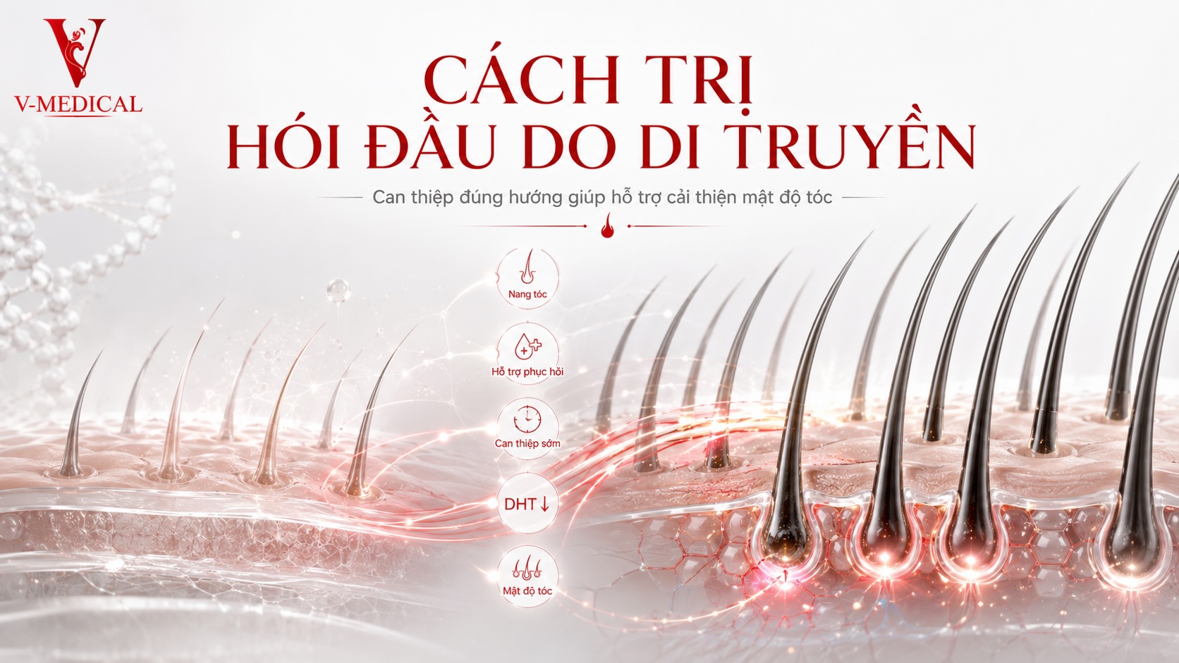 Cách trị hói đầu di truyền