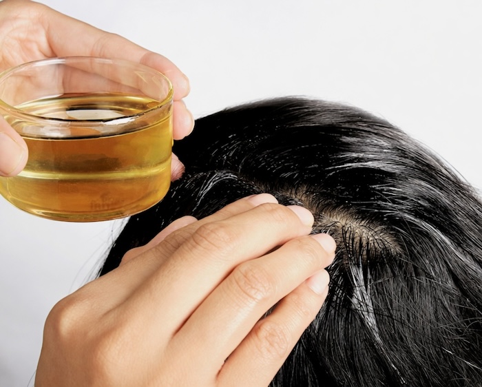 Cách trị hói đỉnh đầu tại nhà