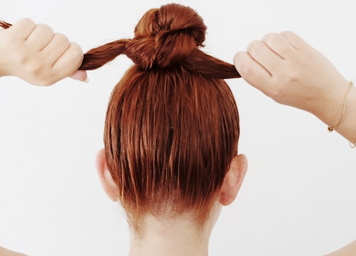 Cách trị hói trán ở nữ tại nhà