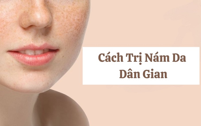 Cách trị nám da dân gian 2010