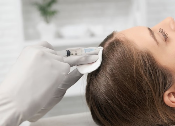 Cấy tóc ở việt nam