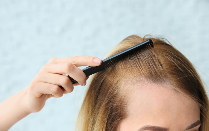 Con gái sớm hói chẳng mong