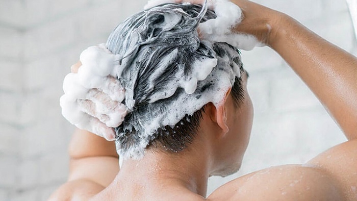 Dầu gội cho người hói đầu