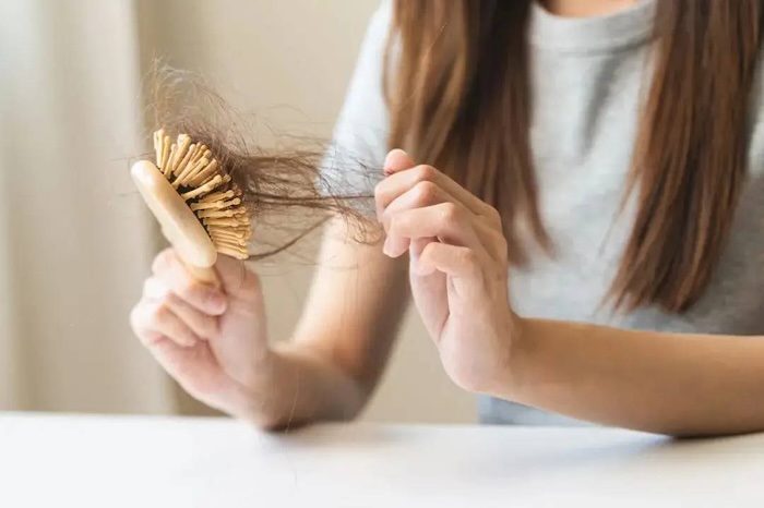 Dấu hiệu của việc hói đầu