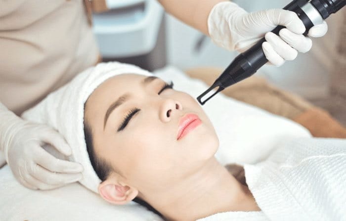 Đốt nám bằng laser