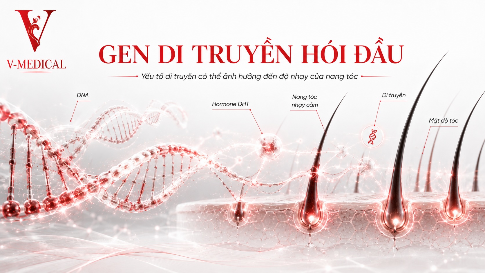 Gen di truyền hói đầu Gen di truyền hói đầu